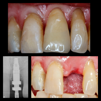 Before After - Cassioroad